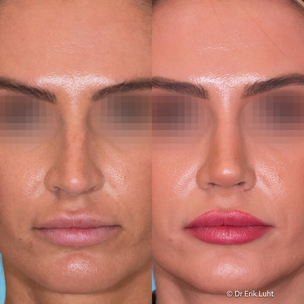 Eriko Luhto portfelis-354