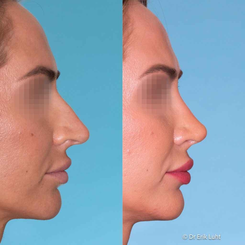 Eriko Luhto portfelis-355