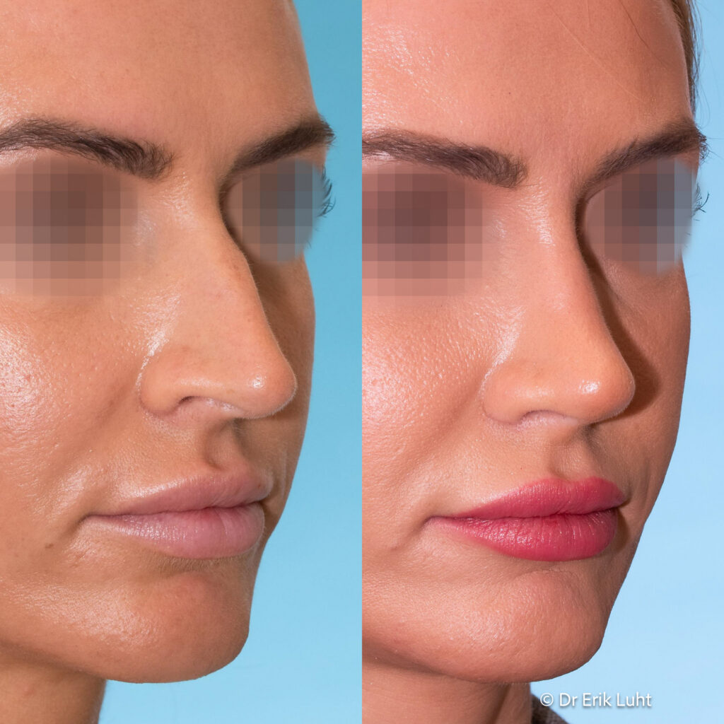 Eriko Luhto portfelis-356