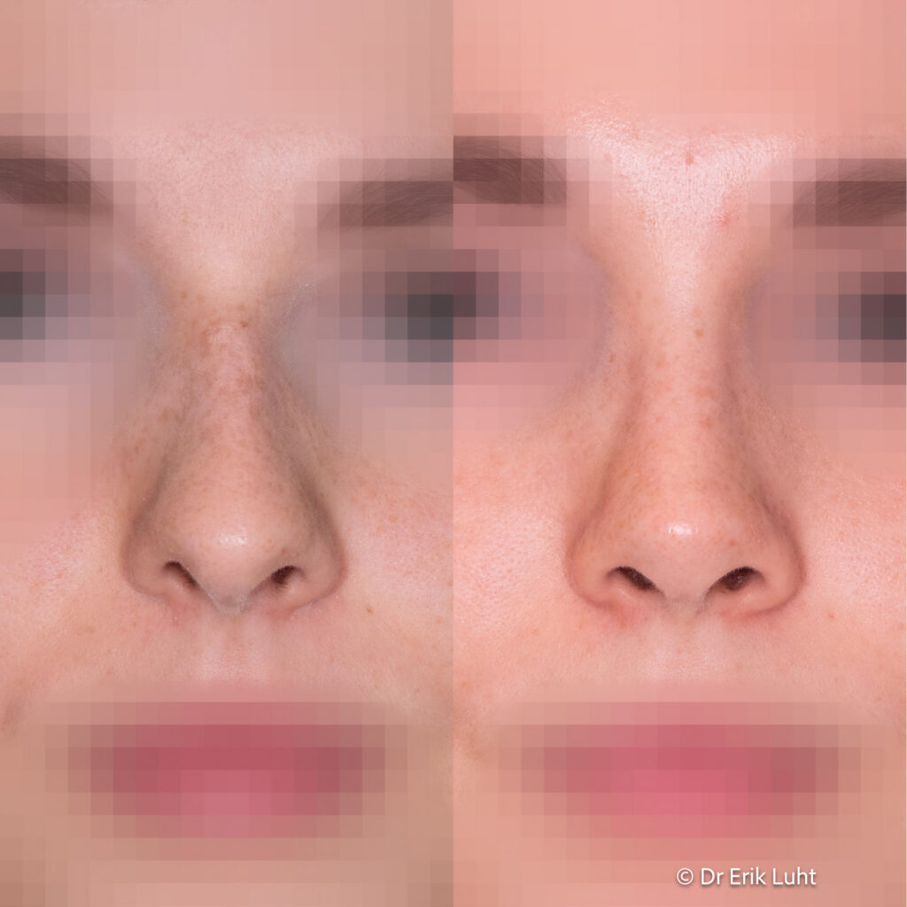 Eriko Luhto portfelis-371