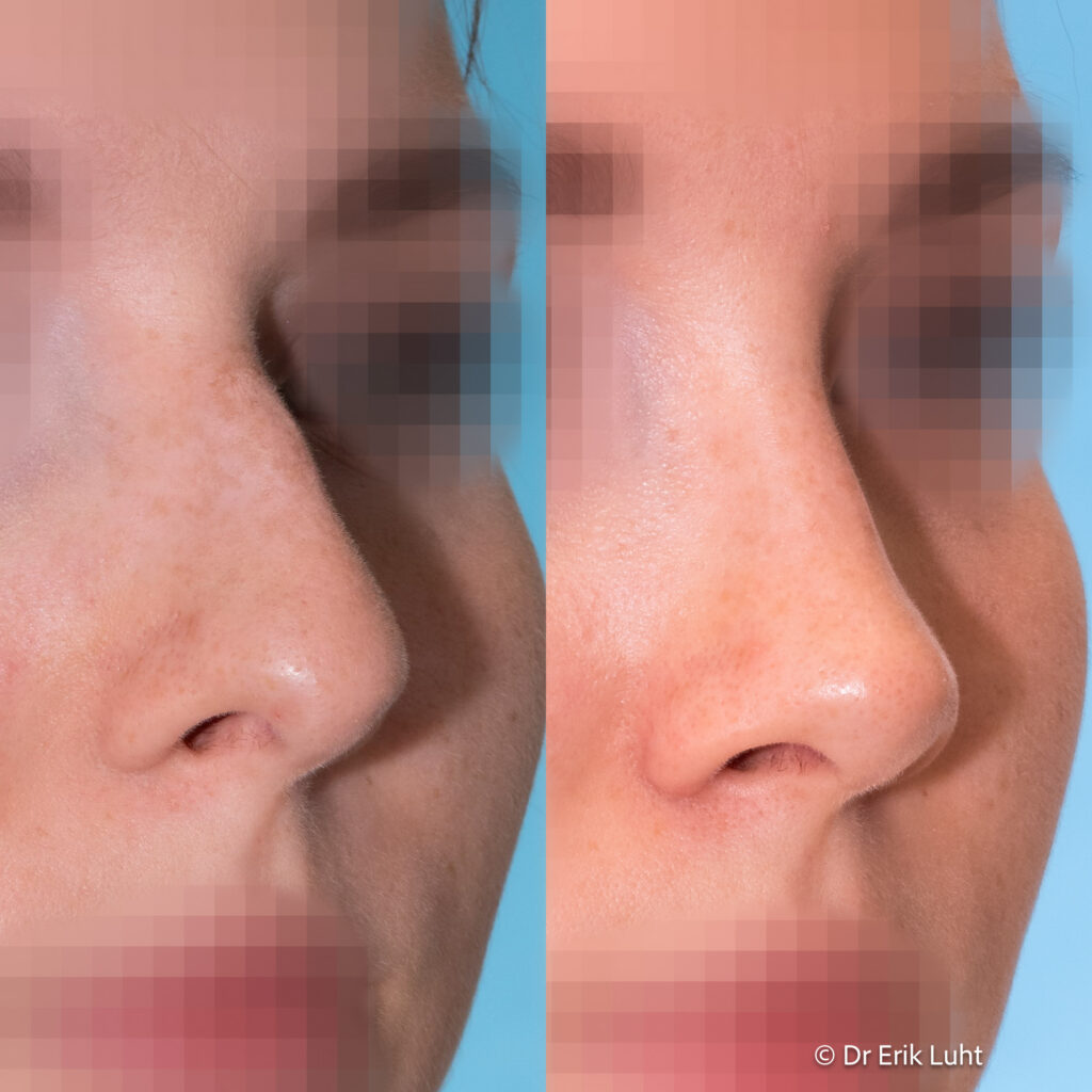 Eriko Luhto portfelis-372