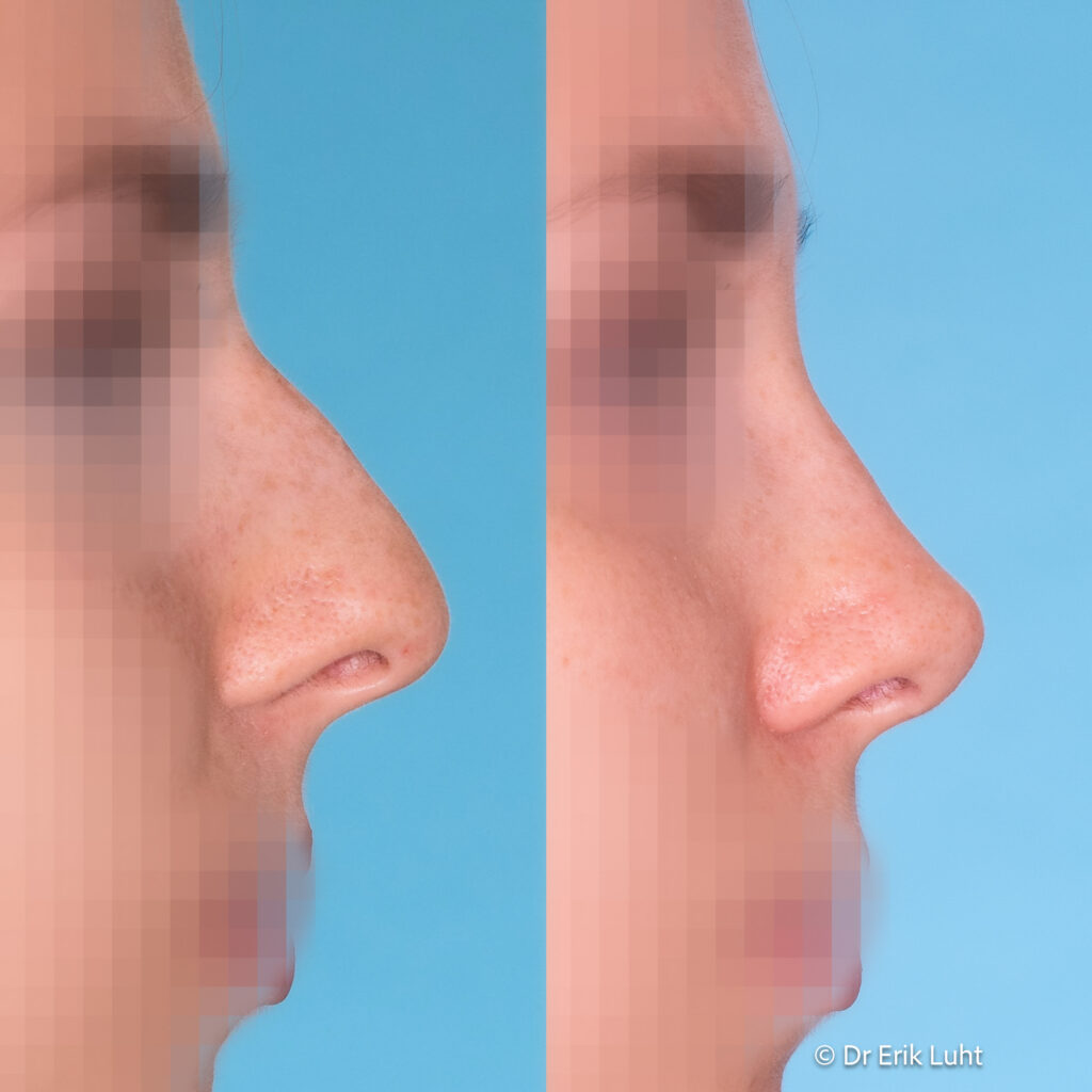 Eriko Luhto portfelis-373