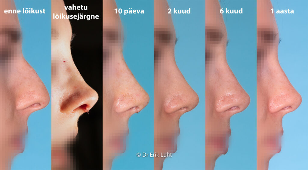 Eriko Luhto portfelis-377