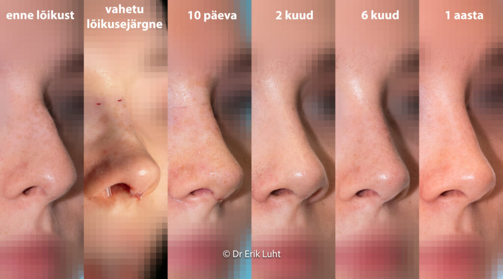 Eriko Luhto portfelis-378