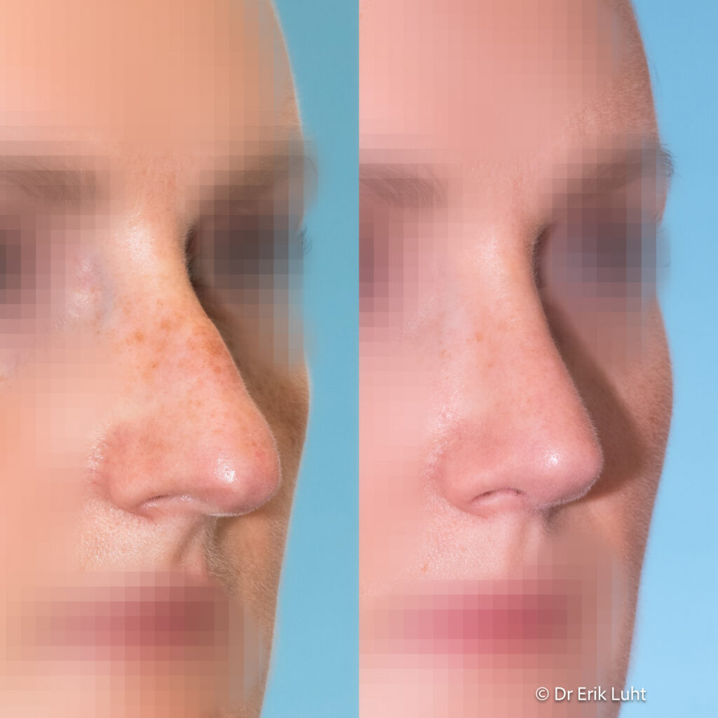 Eriko Luhto portfelis-391