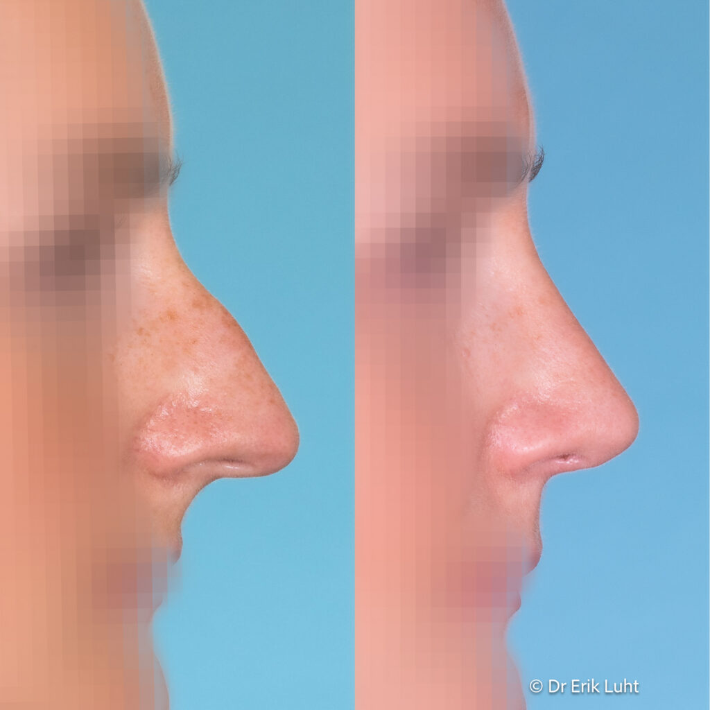 Eriko Luhto portfelis-392