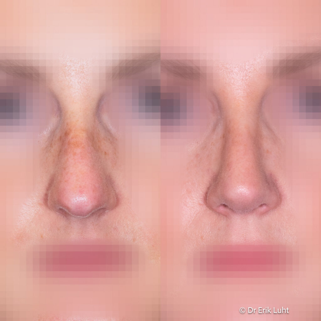 Eriko Luhto portfelis-393