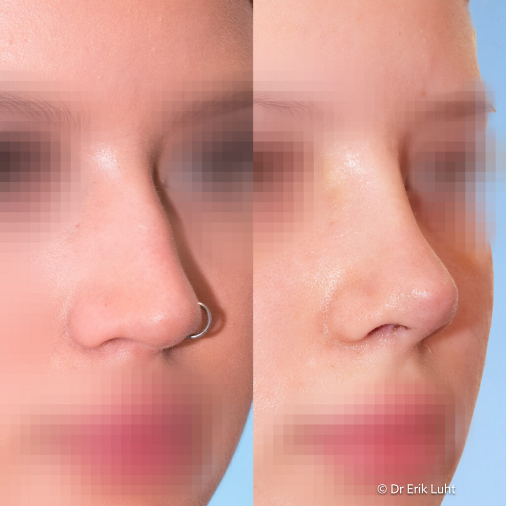 Eriko Luhto portfelis-396