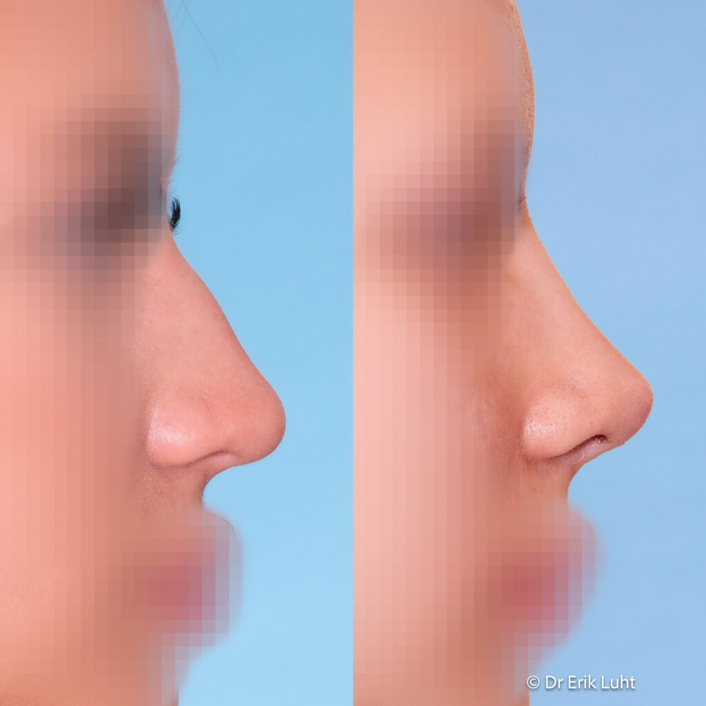 Eriko Luhto portfelis-397