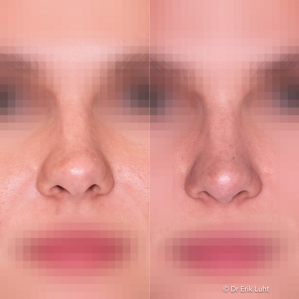 Eriko Luhto portfelis-400