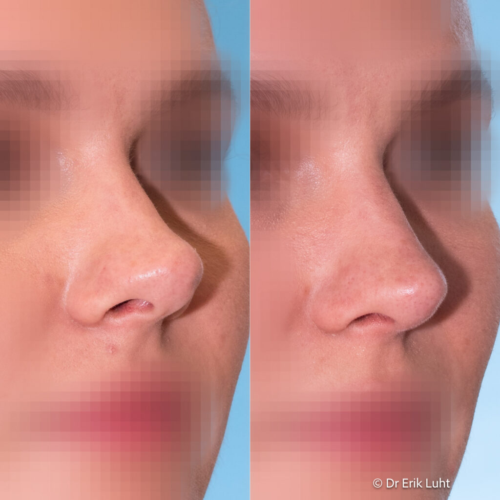 Eriko Luhto portfelis-401