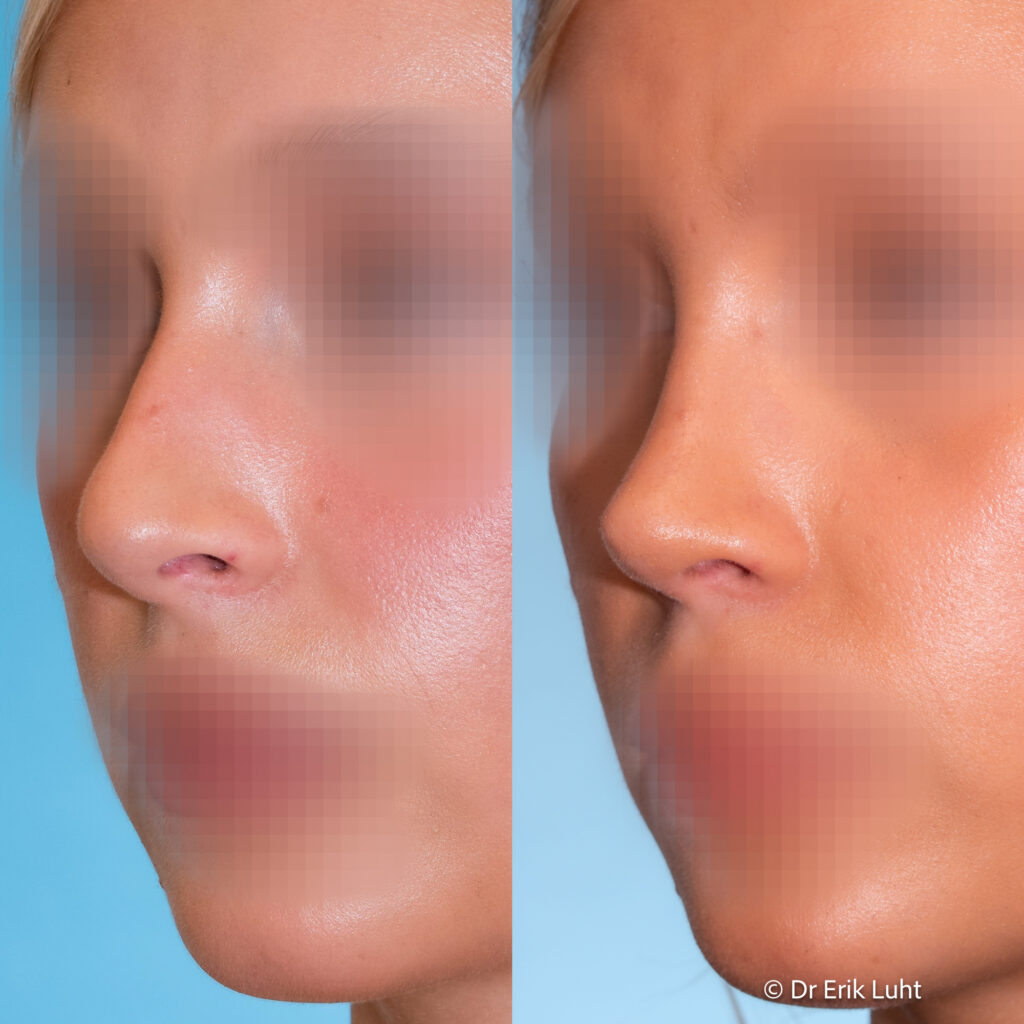 Eriko Luhto portfelis-405