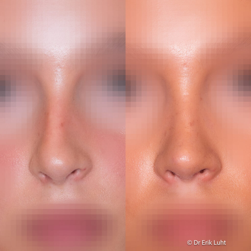 Eriko Luhto portfelis-406