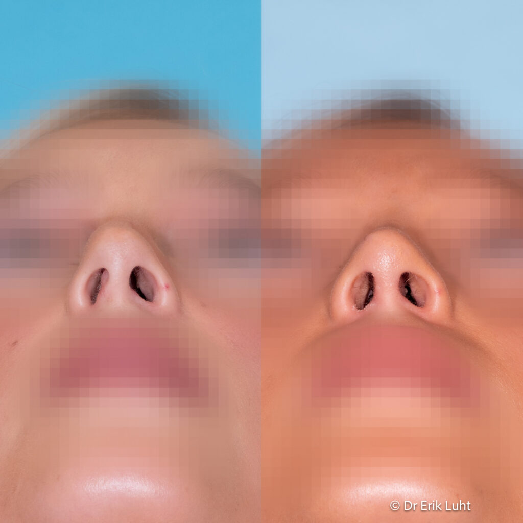 Eriko Luhto portfelis-407