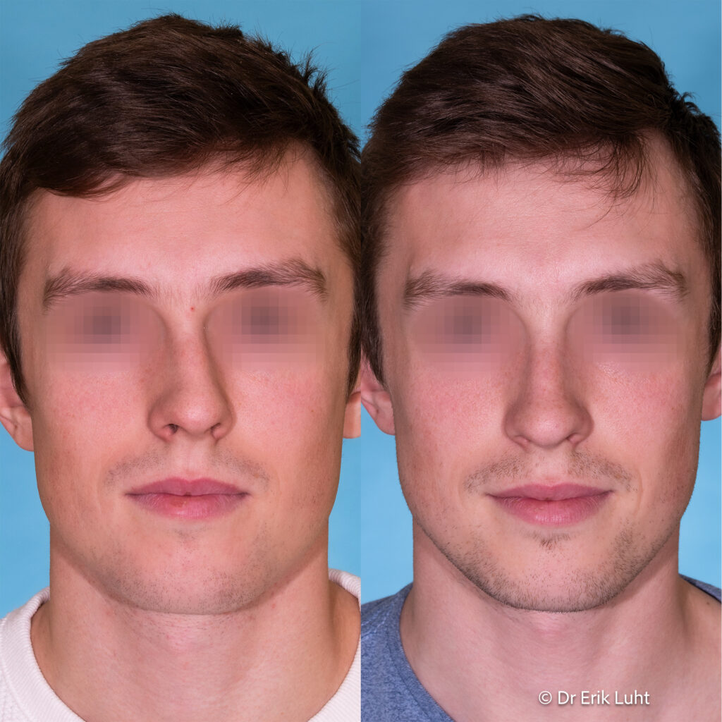 Eriko Luhto portfelis-411