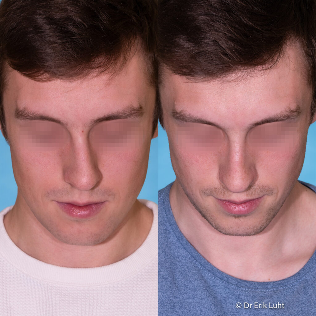 Eriko Luhto portfelis-412