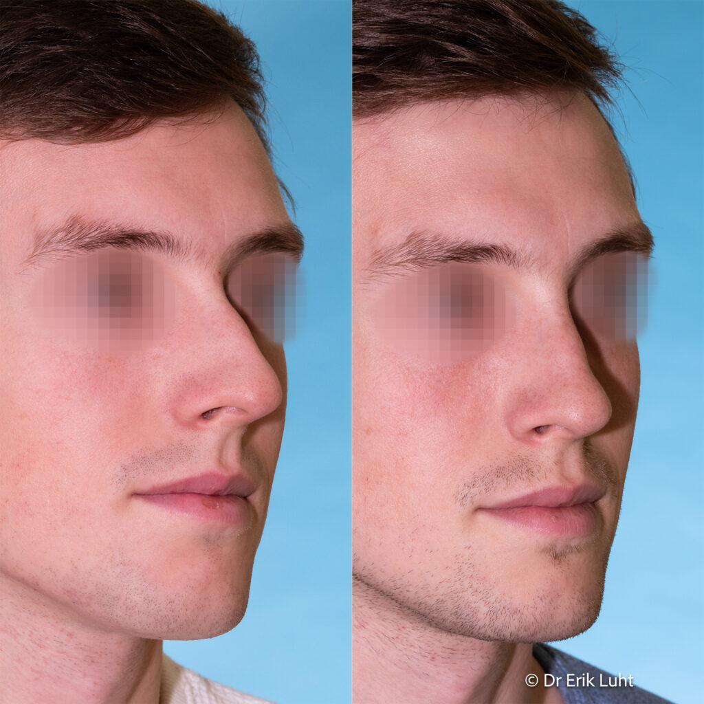 Eriko Luhto portfelis-413