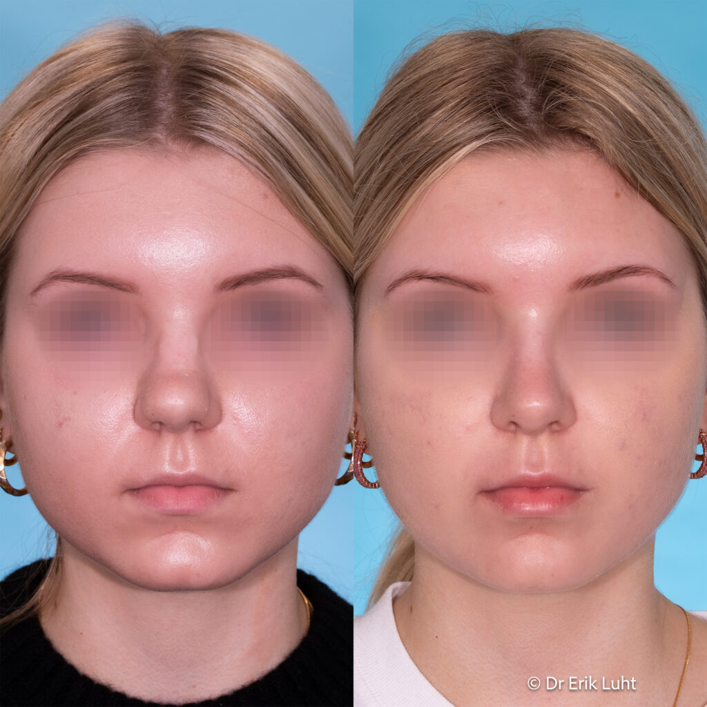 Eriko Luhto portfelis-418