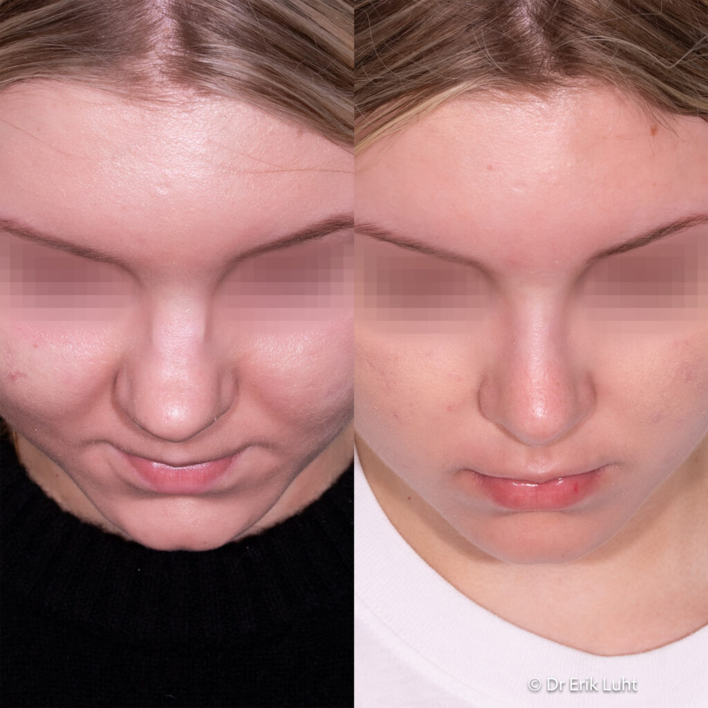 Eriko Luhto portfelis-419