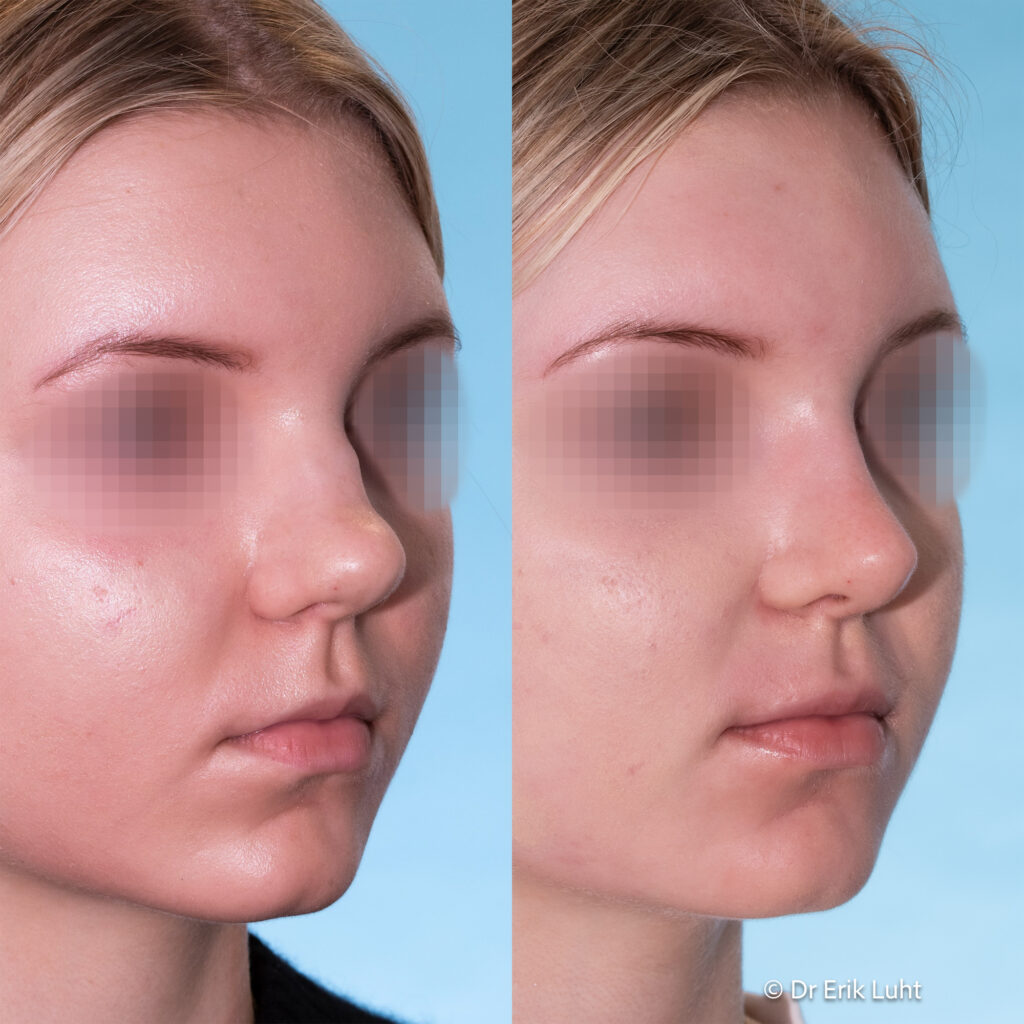 Eriko Luhto portfelis-420