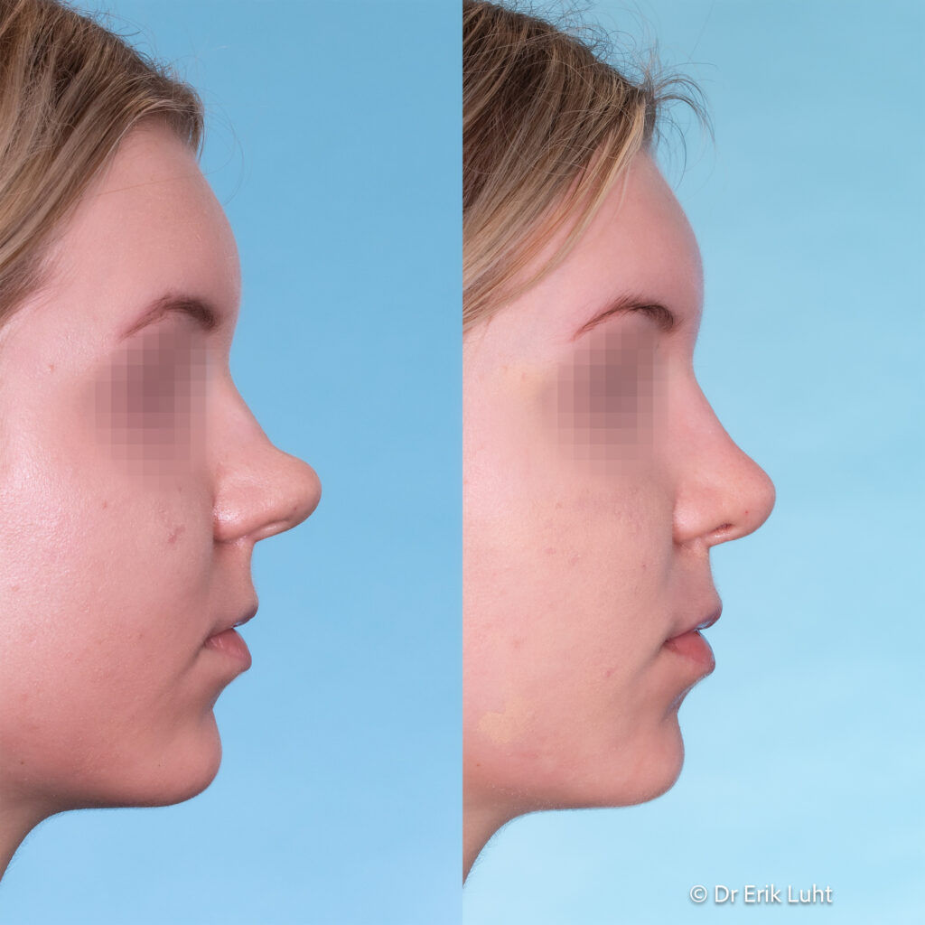 Eriko Luhto portfelis-421