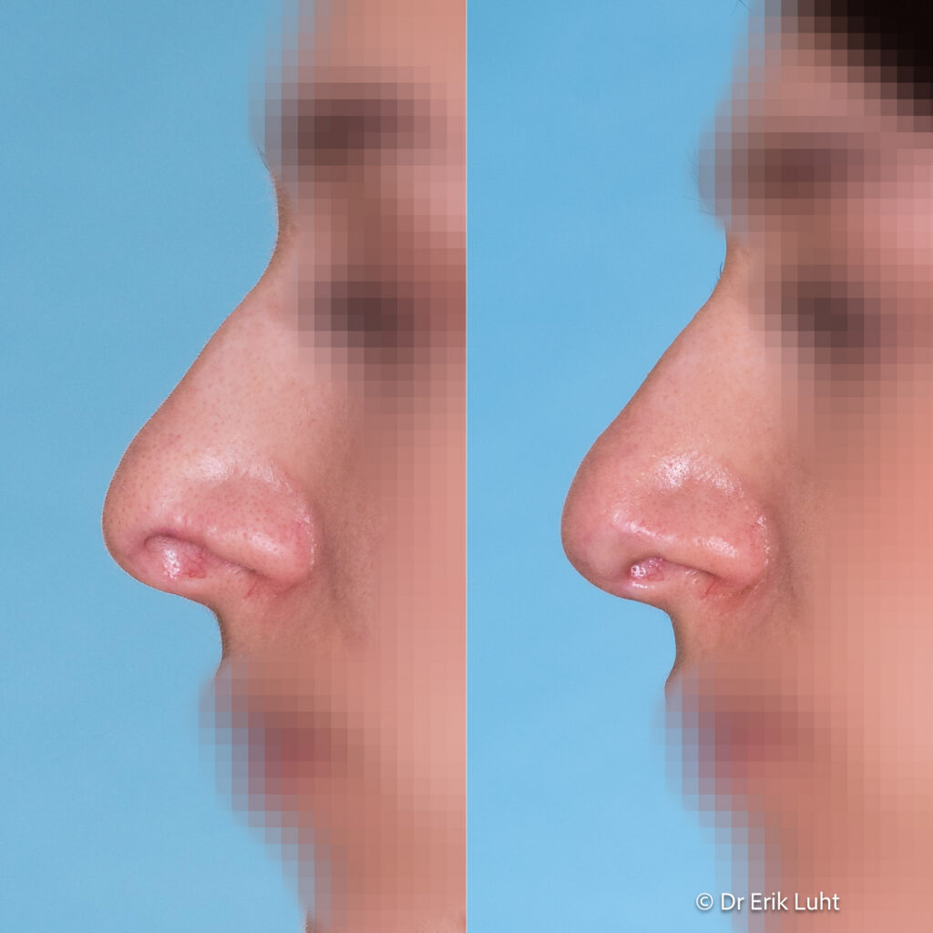 Eriko Luhto portfelis-427