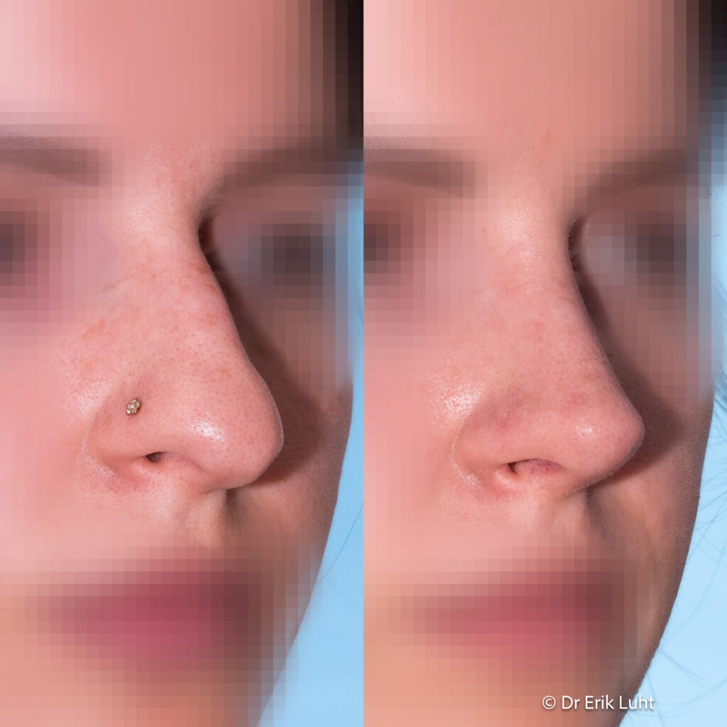 Eriko Luhto portfelis-430