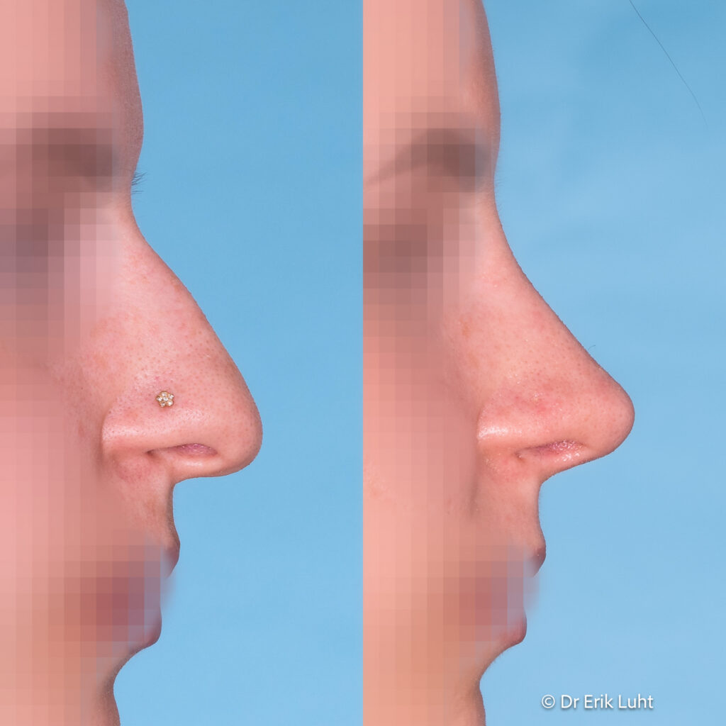 Eriko Luhto portfelis-431