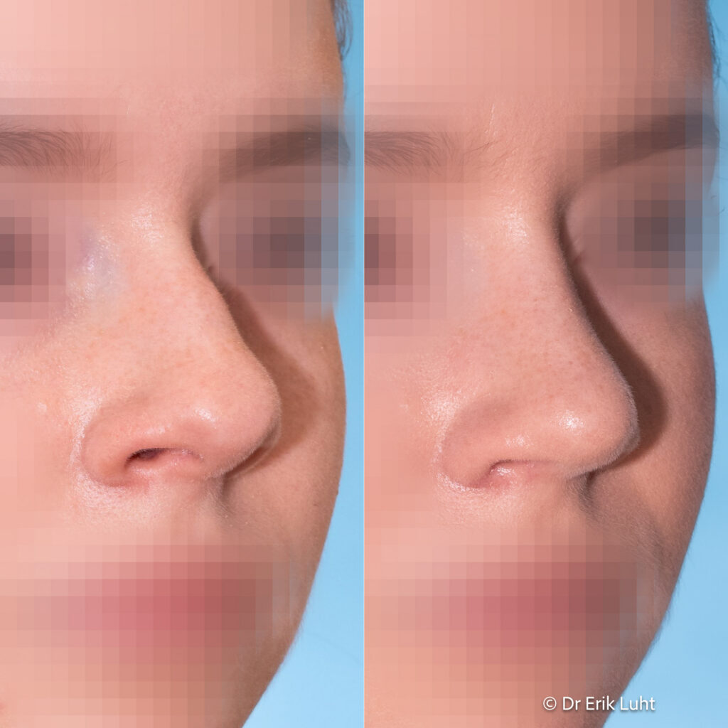 Eriko Luhto portfelis-432