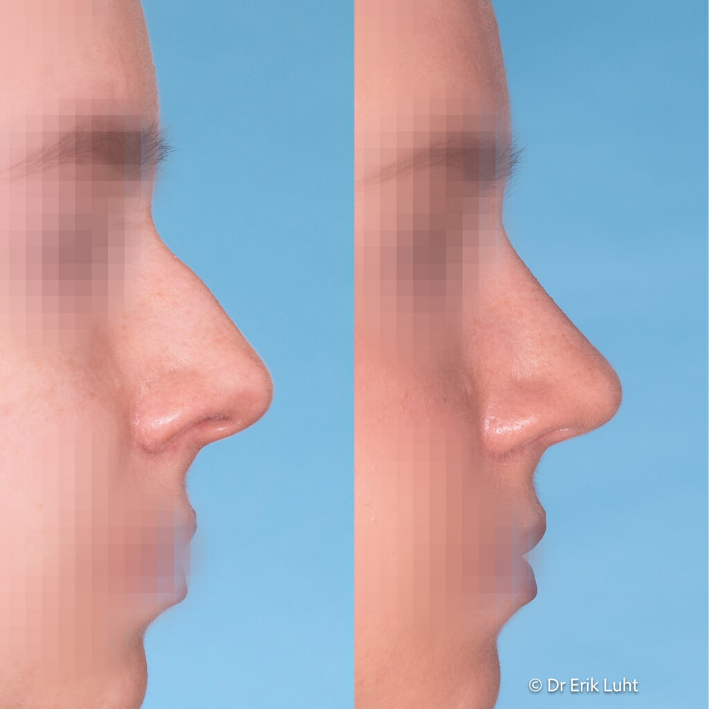 Eriko Luhto portfelis-434