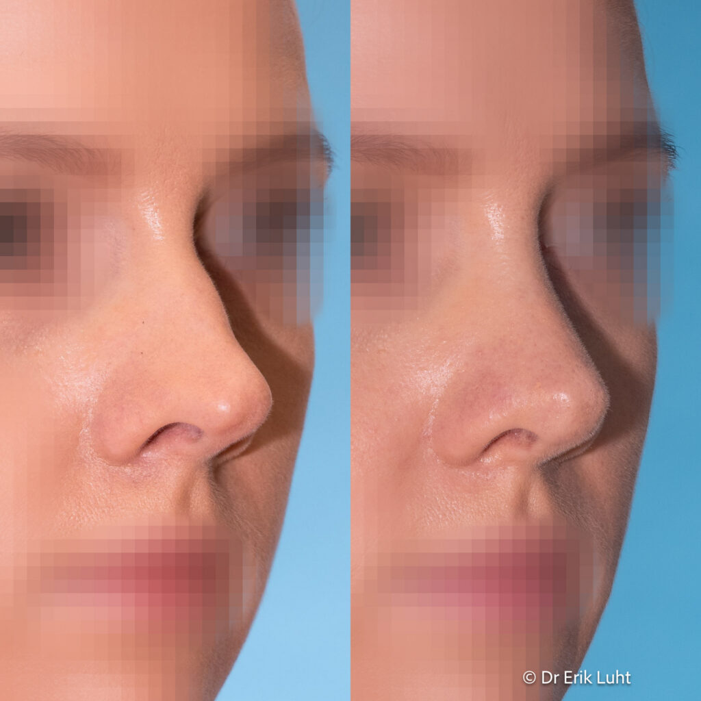 Eriko Luhto portfelis-442