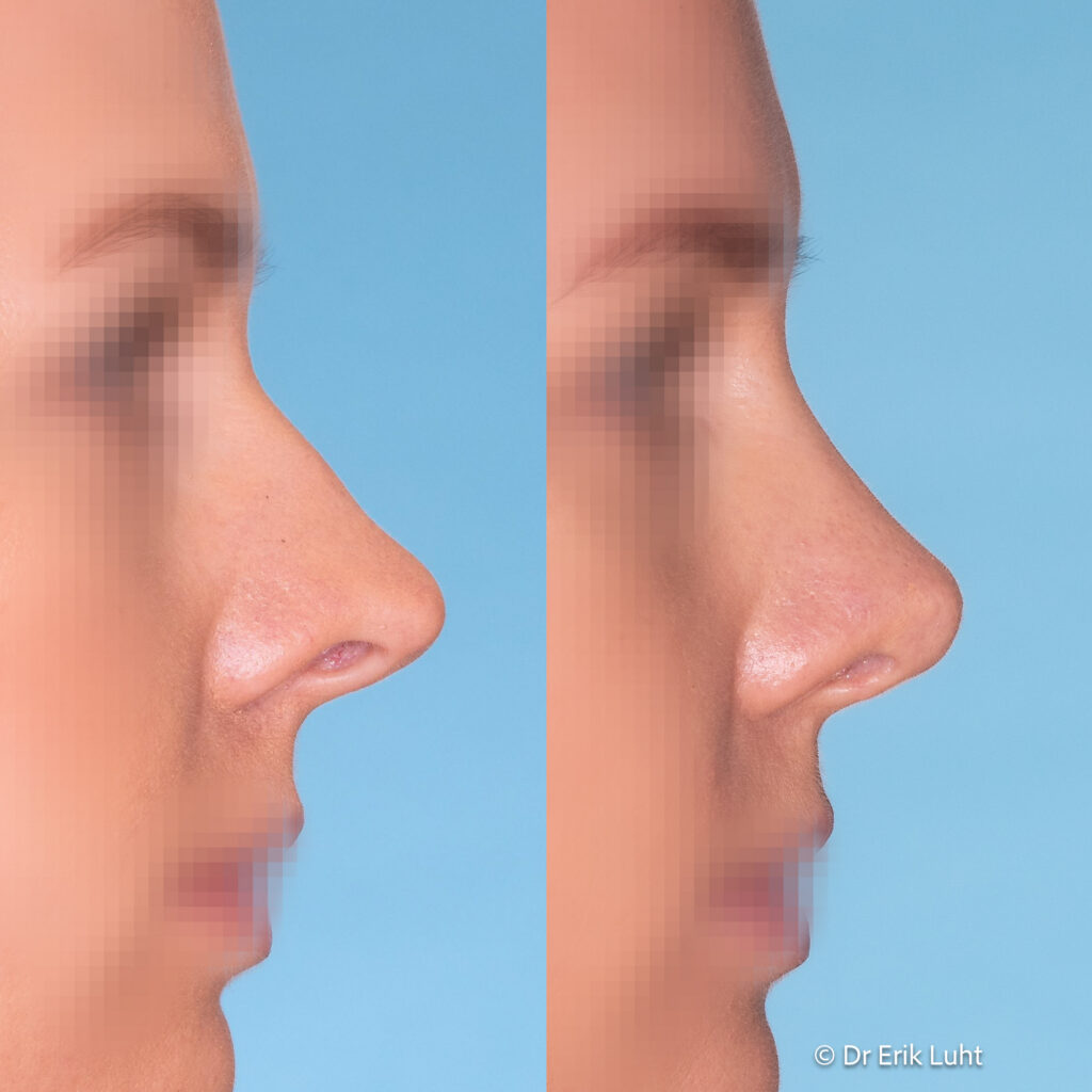 Eriko Luhto portfelis-444