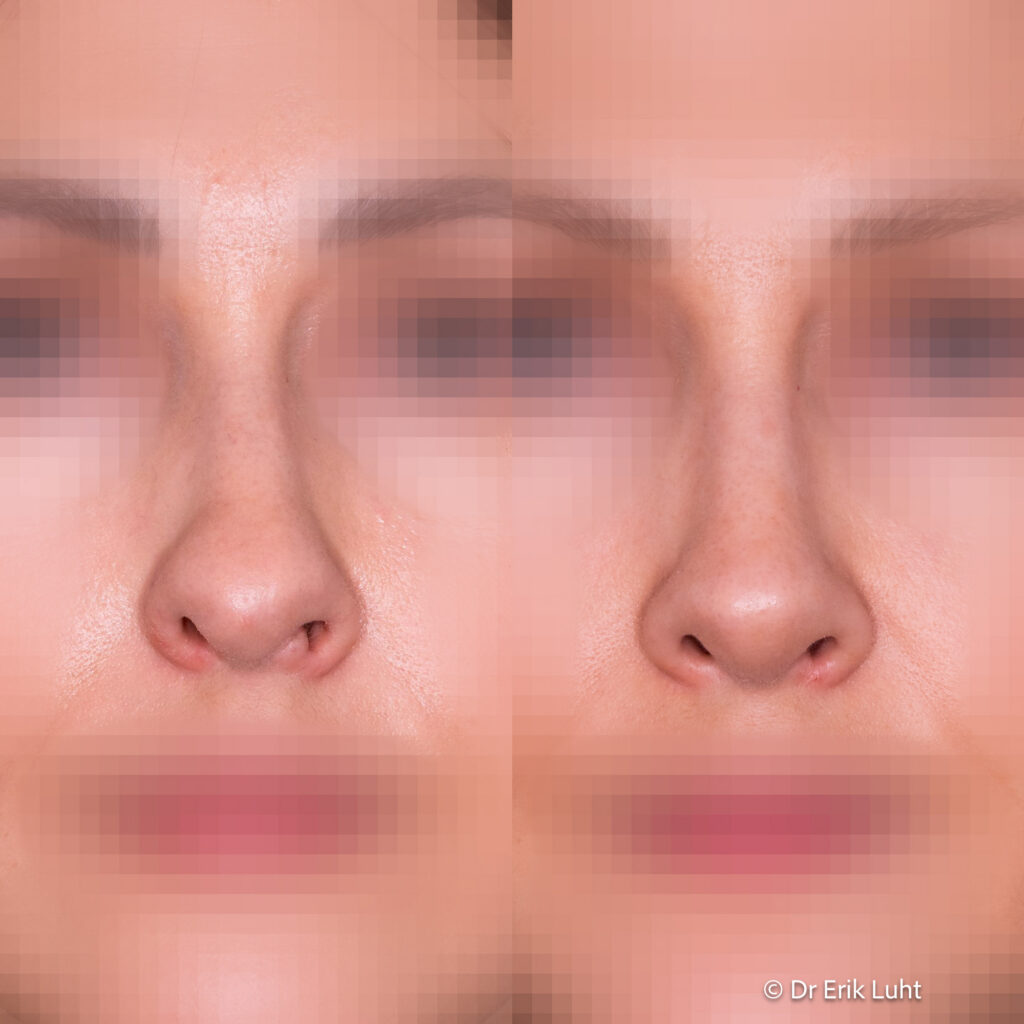 Eriko Luhto portfelis-450