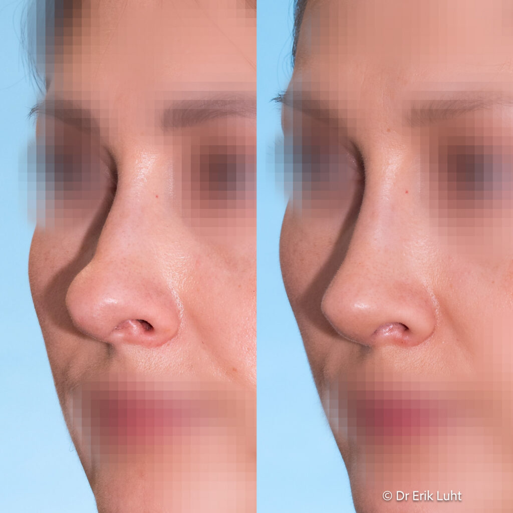 Eriko Luhto portfelis-451