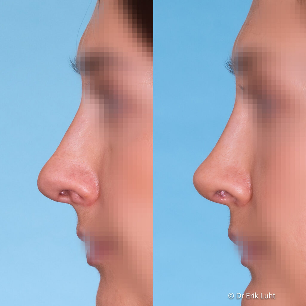 Eriko Luhto portfelis-452