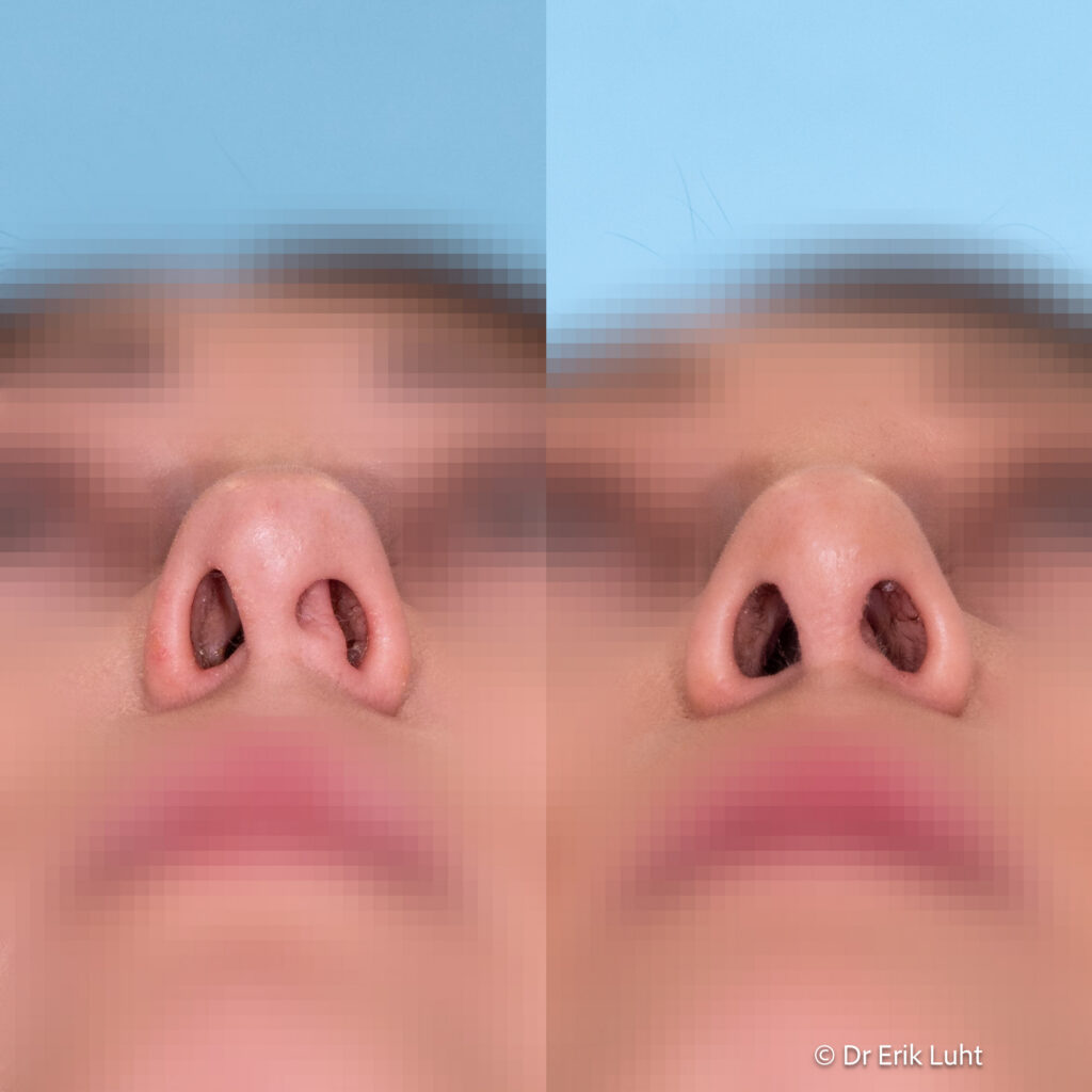 Eriko Luhto portfelis-453