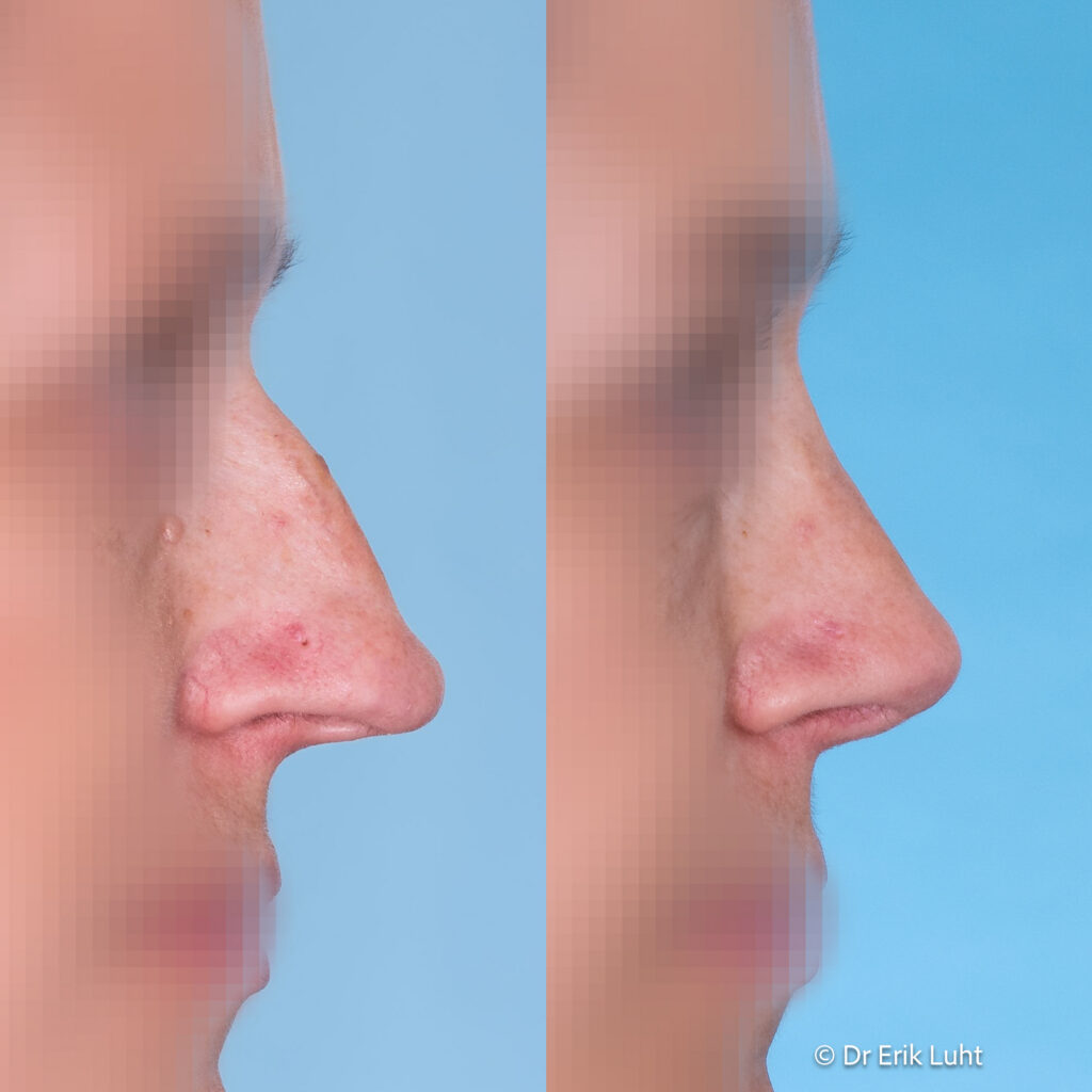 Eriko Luhto portfelis-472