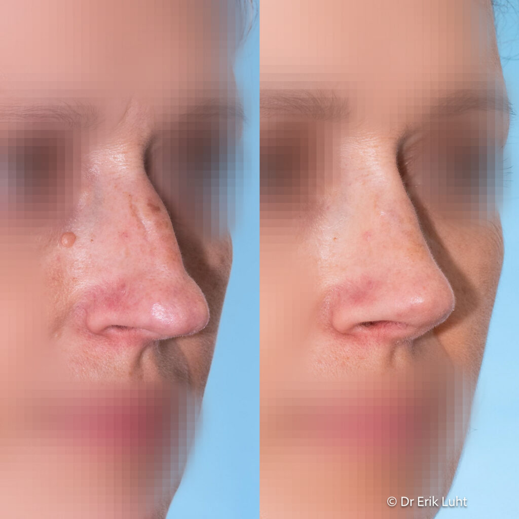 Eriko Luhto portfelis-473