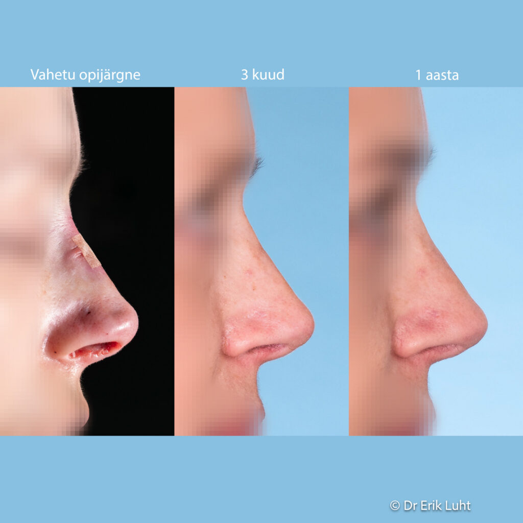 Eriko Luhto portfelis-475